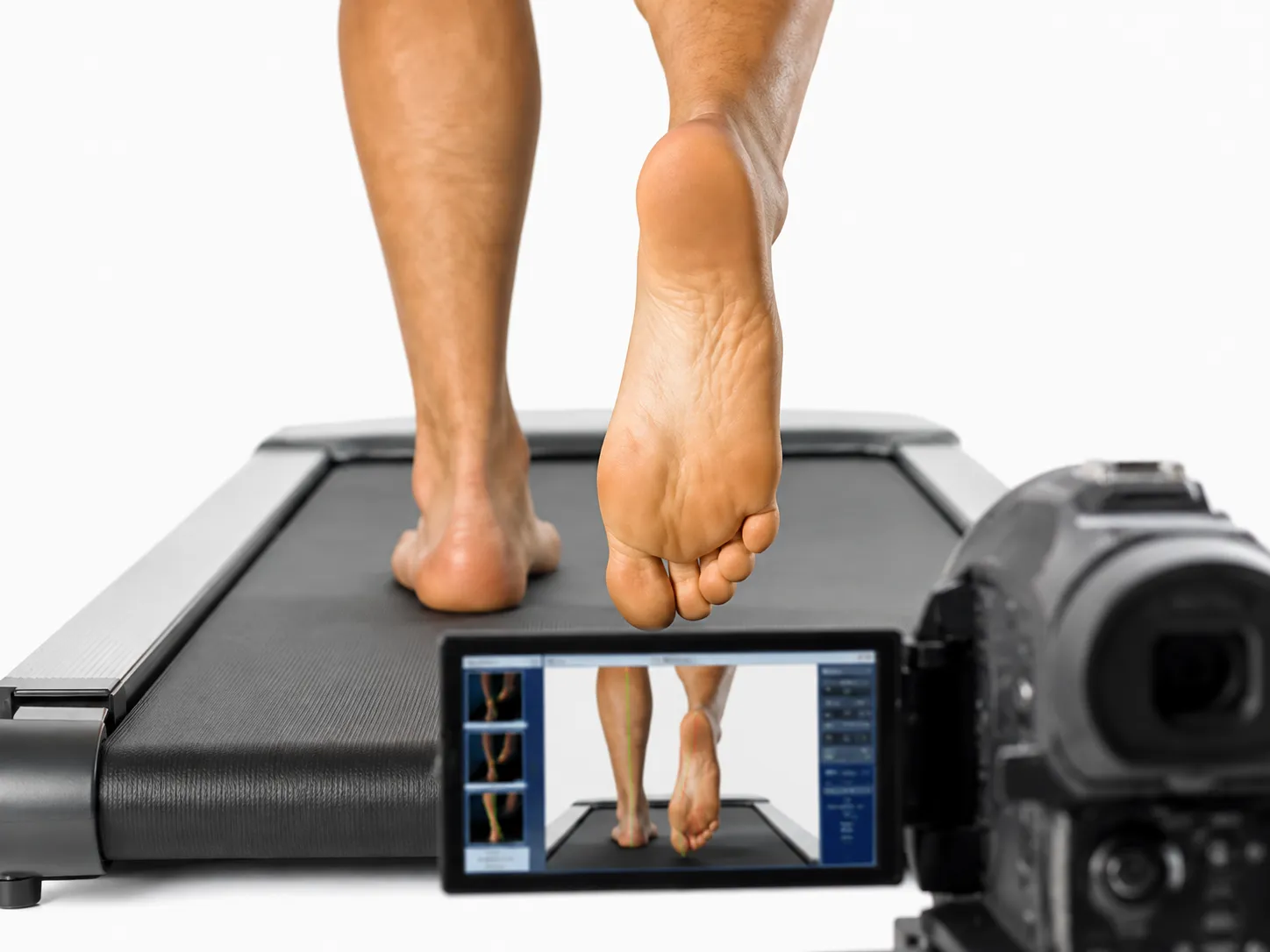 A patient's feet mid-stride on a treadmill, filmed on camera with the slow-motion gait analysis readout on a monitor
