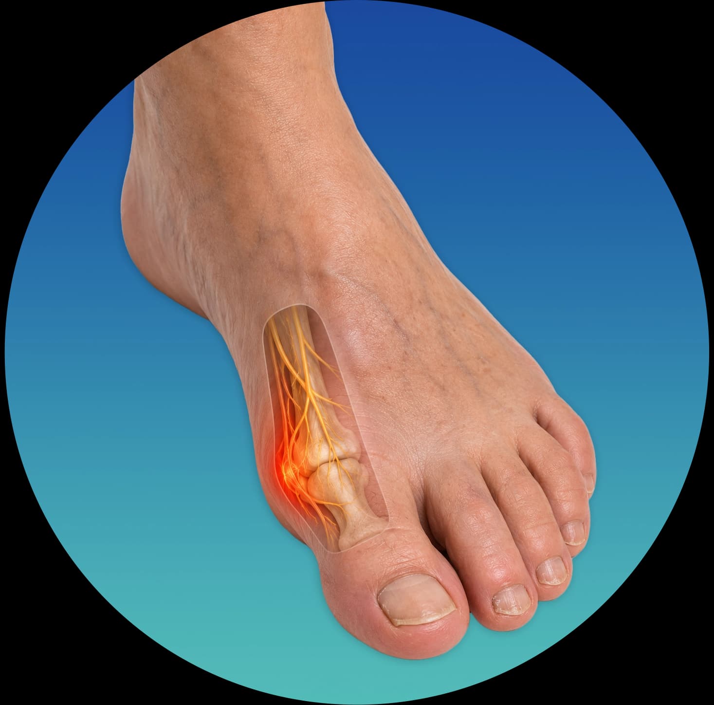 Diabetic foot care — protecting feet and preserving mobility